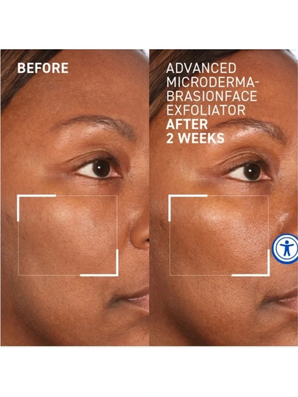 Dr. Brandt Microdermabrasion Face Exfoliator - NEW! FULL SIZE!